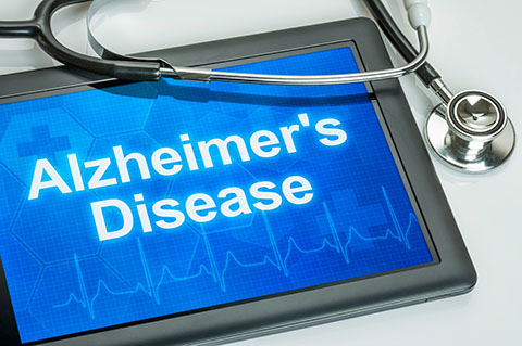 diagnosing alzheimers properly was much more difficult until recently