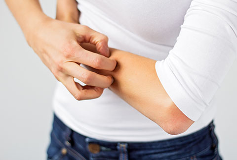 psoriasis itch in the winter months